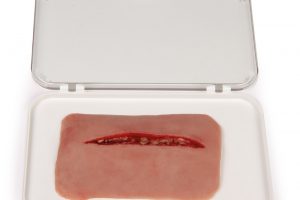 Wundmoulage Schnittwunde