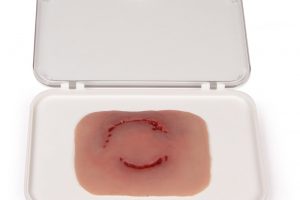 Wundmoulage Bisswunde Mensch