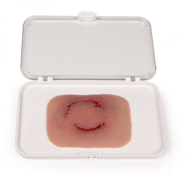 NW0051 Wundmoulage Bisswunde Mensch