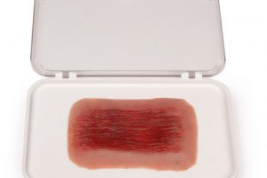Wundmoulage Schürfwunde