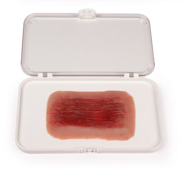 NW006_1 Wundmoulage Schürfwunde