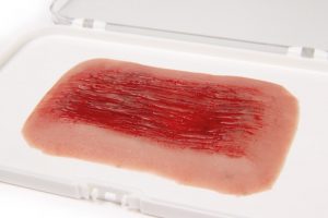 Wundmoulage Schürfwunde