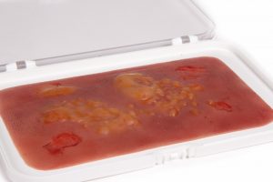 Wundmoulage Brandwunde 2. Grades