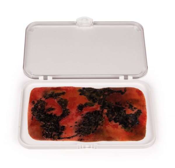 NW008_1 Wundmoulage Brandwunde 3. Grades