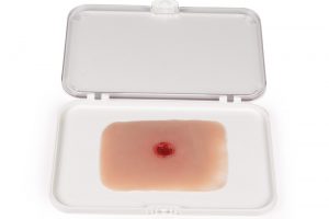 Wundmoulage Einschußwunde