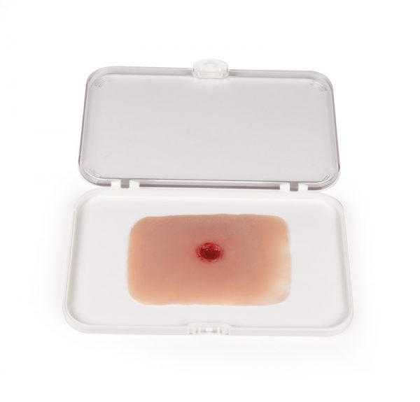 NW010a_1 Wundmoulage Einschußwunde