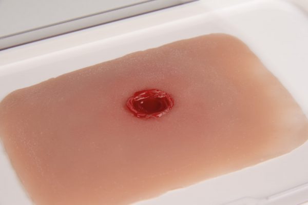 NW010a_2 Wundmoulage Einschußwunde