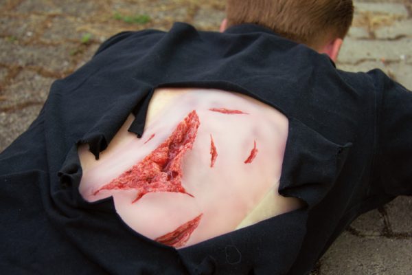 NW101_Action1 Risswunde groß mit Blutungsfunktion