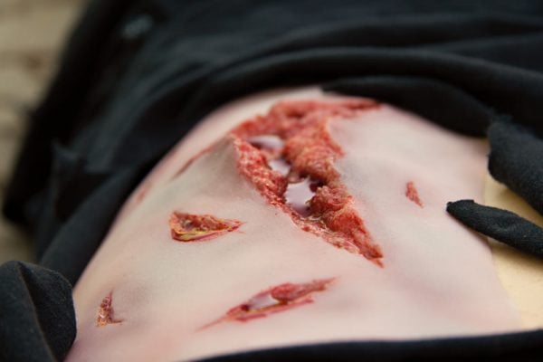 NW101_Action3 Risswunde groß mit Blutungsfunktion