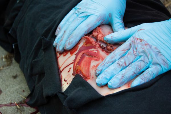 NW101_Action5 Risswunde groß mit Blutungsfunktion