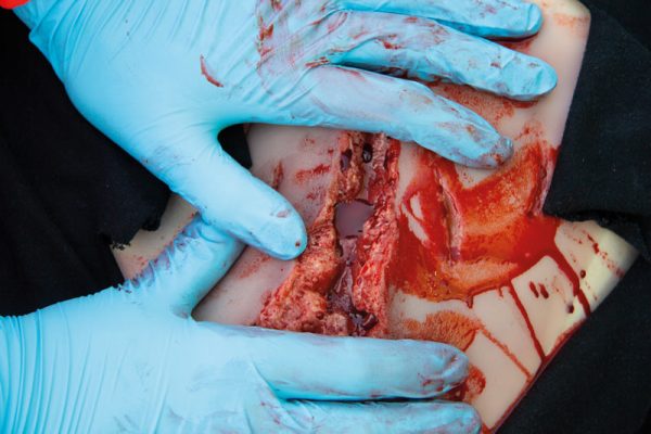 NW101_Action7 Risswunde groß mit Blutungsfunktion