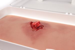 Offener Bruch Arm mit Blutungsfunktion