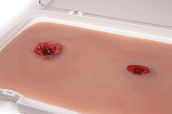 NW104_2 Schusswunde Arm mit Blutungsfunktion