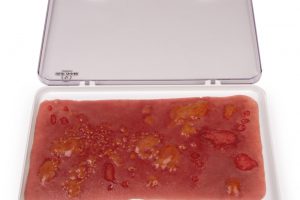 Wundmoulage Verbrennung II. Grades