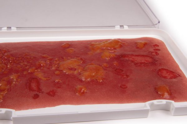 NW106_2 Wundmoulage Verbrennung II. Grades