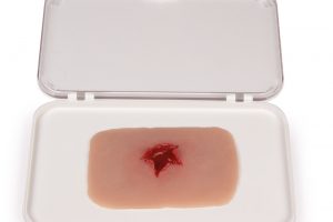 Wundmoulage Schuß Austrittswunde