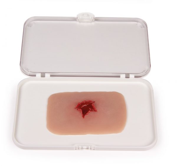 NW10b_1 Wundmoulage Schuß Austrittswunde