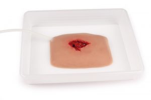 Wundmoulage wound packing
